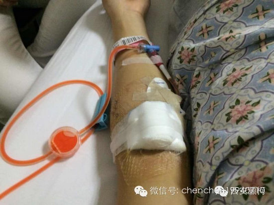 兩年間母親爺爺離世 19歲少女腫瘤晚期笑對病魔